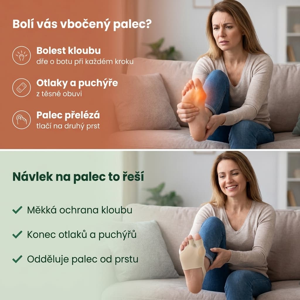 Návlek na palec nohy při hallux valgus, otlacích a překrývání palce